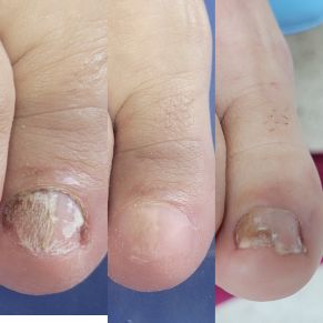 109 Foto 2 vitalpies